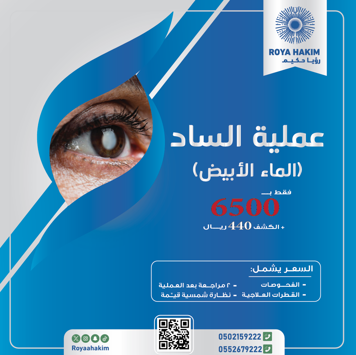 الساد 2